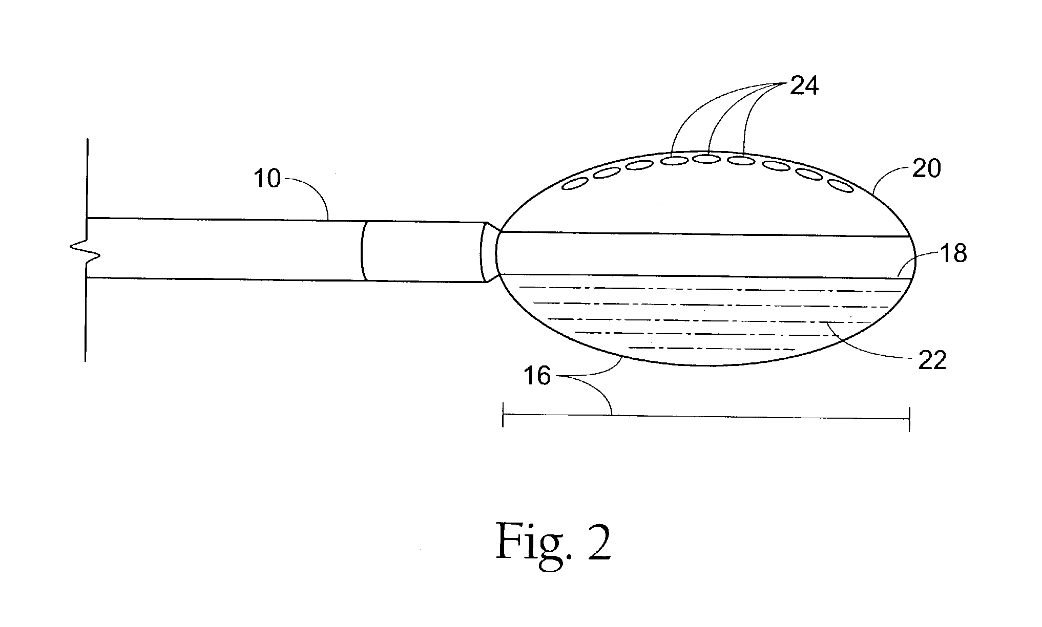 Sphincter treatment method