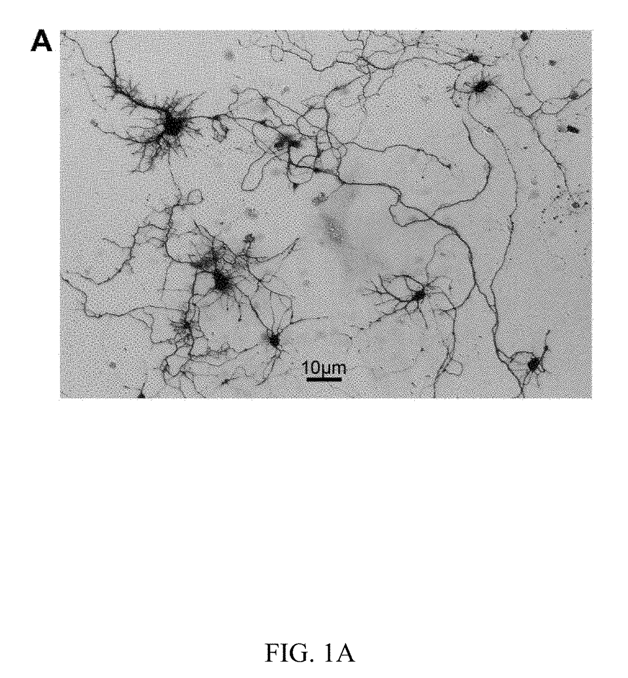 Metabolic therapy for oxidative stress in the brain through targeted neuronal catabolism of n-acetyl-aspartic acid