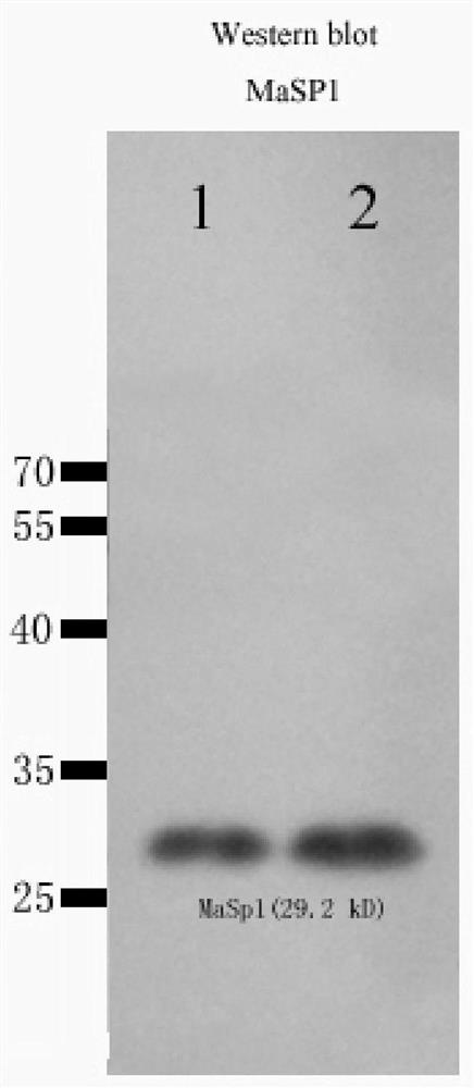 A kind of degradable tissue repair material and preparation method