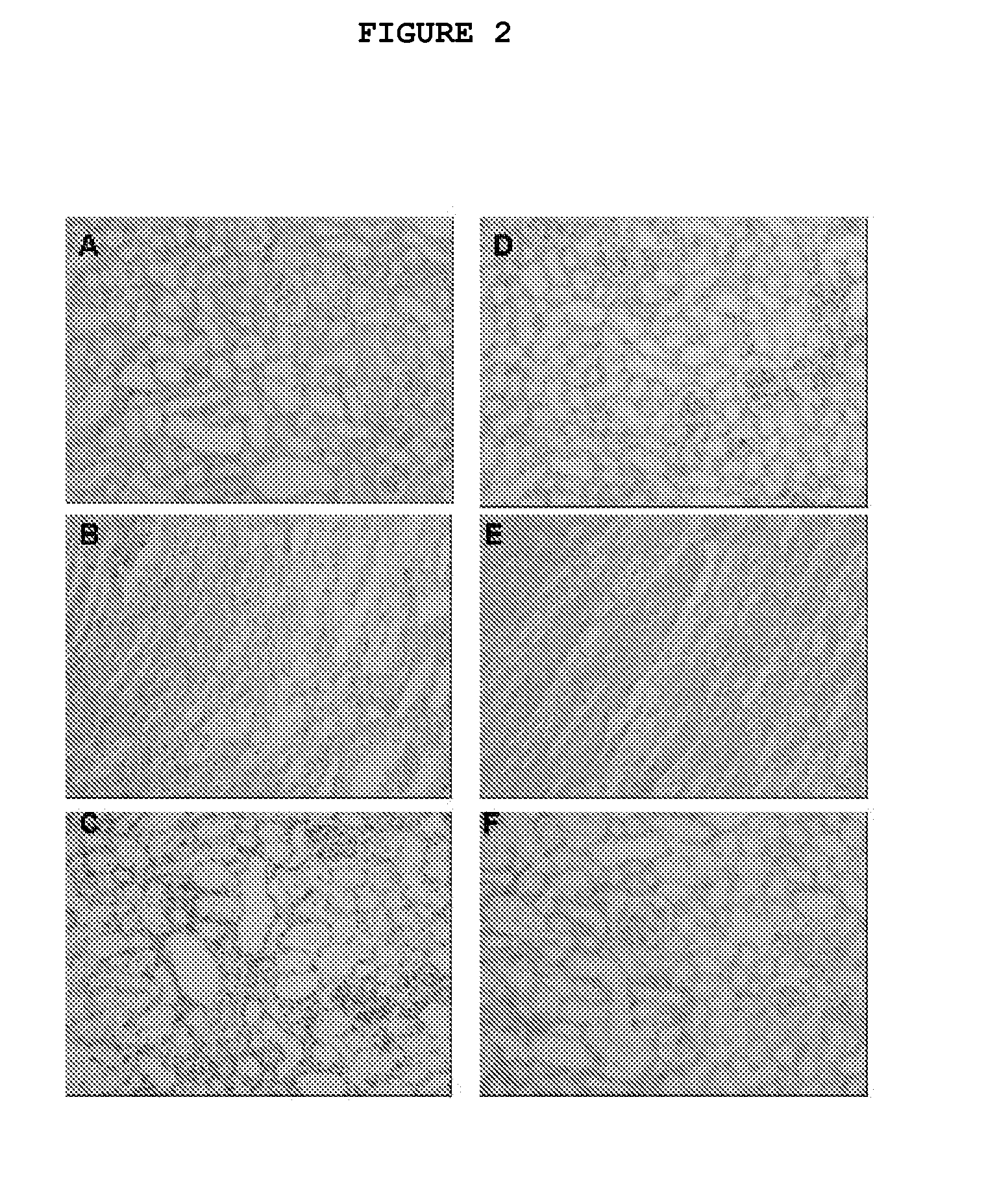 Composition and Method for Treating Fibrotic Diseases