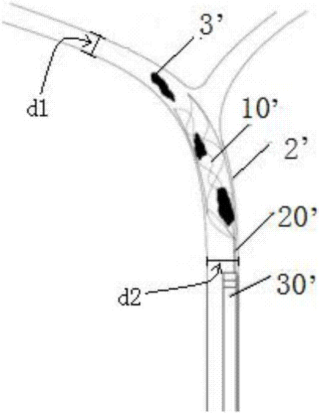 Thrombus extraction bracket and thrombus extraction device