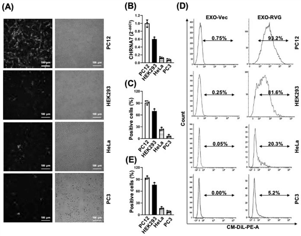 Exosome containing CD10-dm protein as well as preparation method and application of exosome