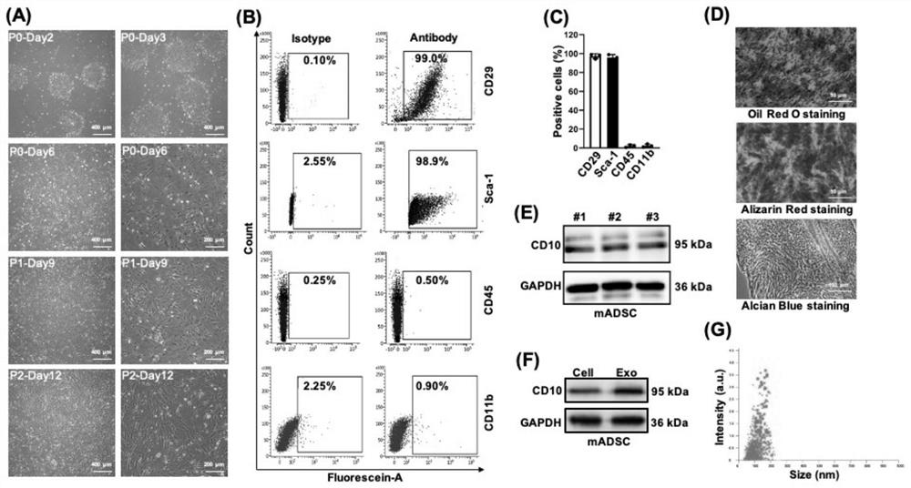 Exosome containing CD10-dm protein as well as preparation method and application of exosome