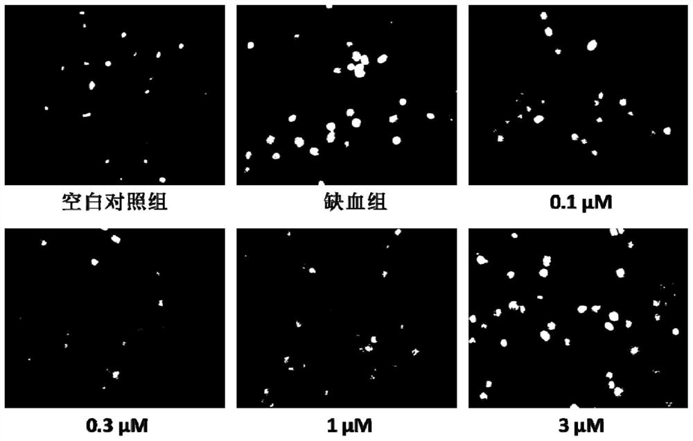 A hydrogen sulfide donor and its preparation method and use