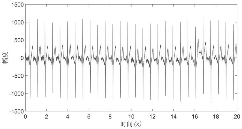 Atrial Fibrillation Analysis and Prediction Method Based on Cardiac Mapping Activation Sequence