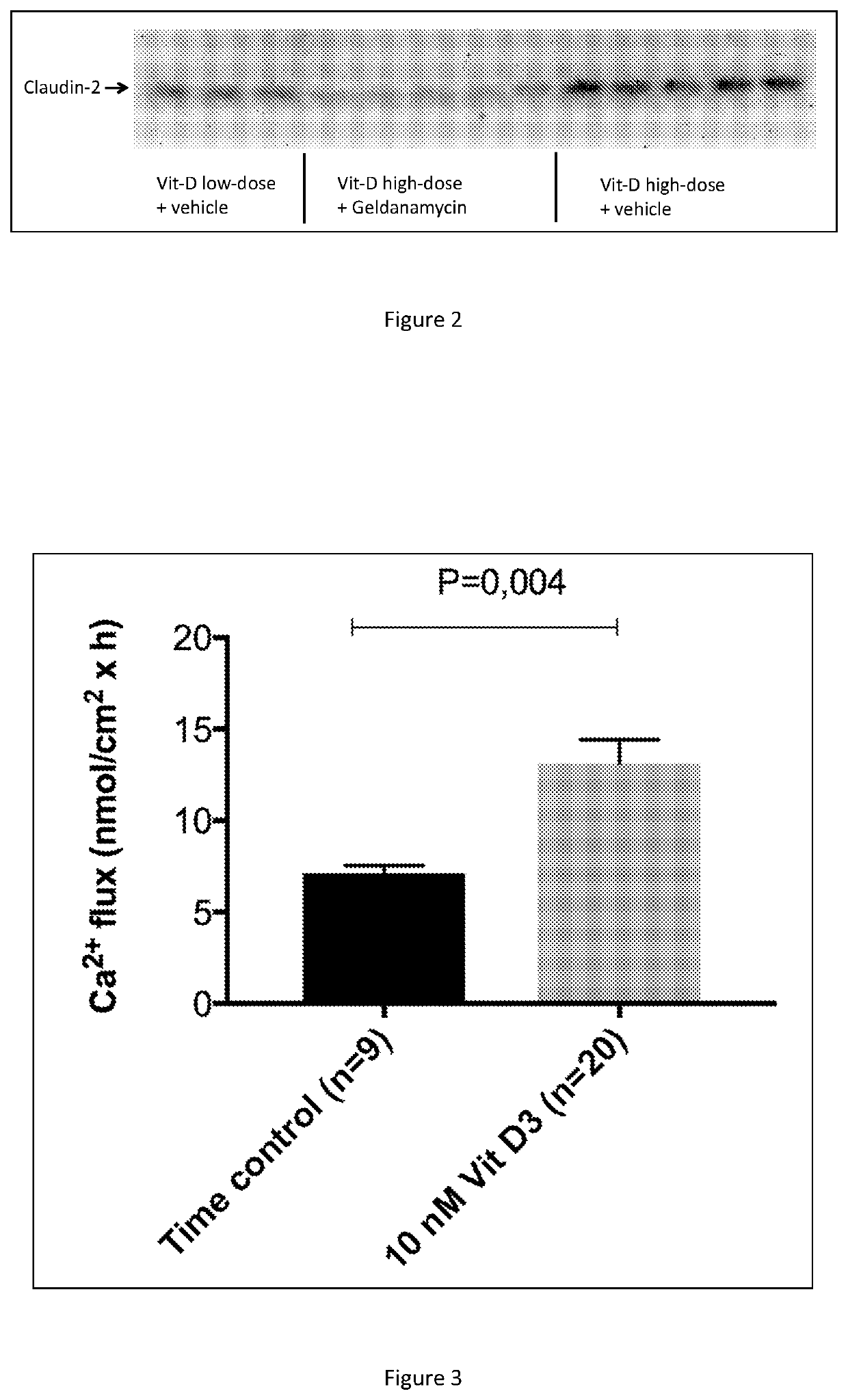 A composition for use in the treatment of conditions caused by calcium deficiency