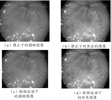 Endoscope focusing control method and system