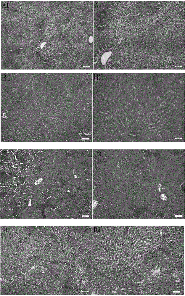 Application of recombinant human cytoglobin in preparation of drugs treating hyperlipidemia and atherosclerosis