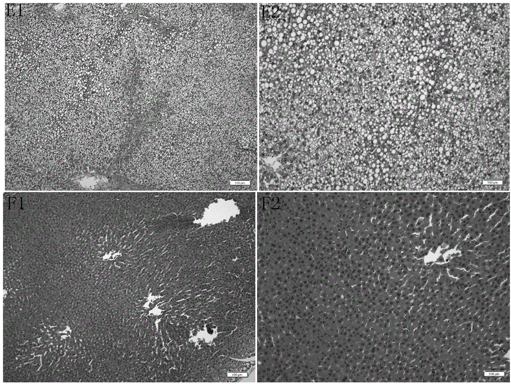 Application of recombinant human cytoglobin in preparation of drugs treating hyperlipidemia and atherosclerosis