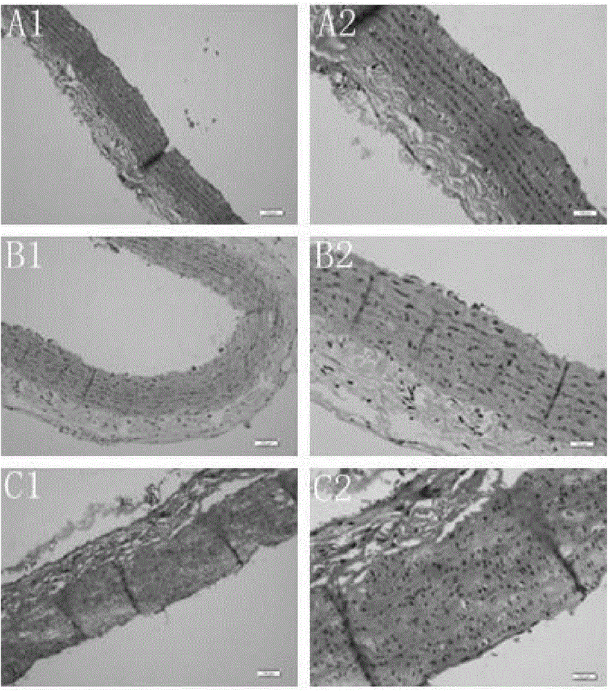 Application of recombinant human cytoglobin in preparation of drugs treating hyperlipidemia and atherosclerosis