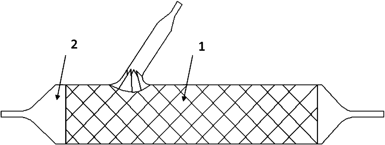 Degradable stent system for bifurcation vascular lesions