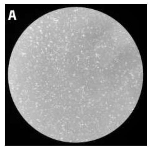 Application of amniotic fluid stem cells in preparation of drugs for treating lupus nephritis