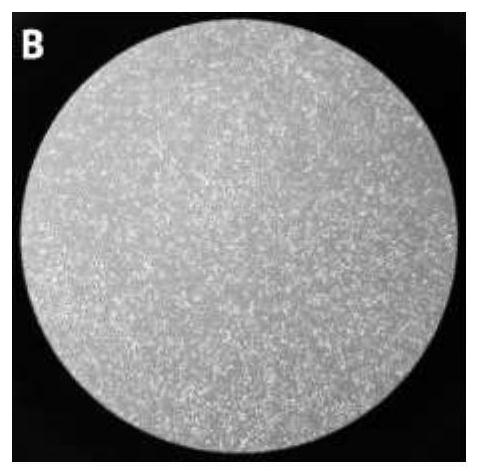 Application of amniotic fluid stem cells in preparation of drugs for treating lupus nephritis