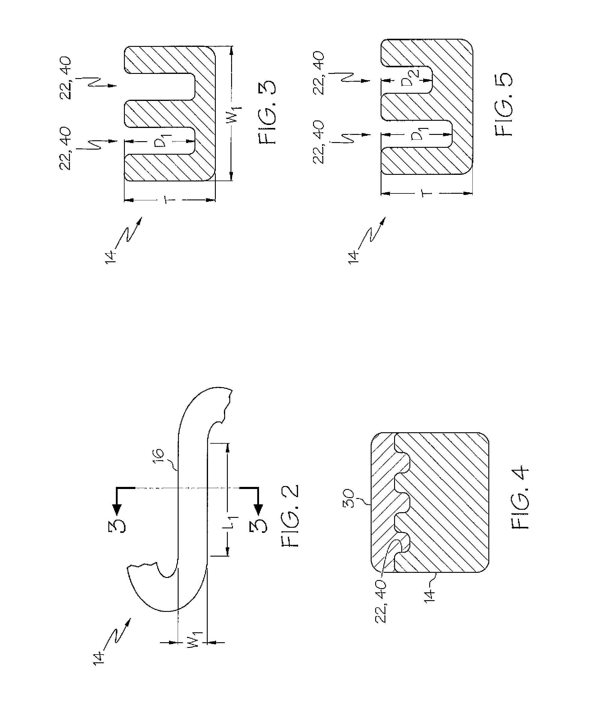 Stent Design Allowing Extended Release of Drug and/or Enhanced Adhesion of Polymer to OD Surface