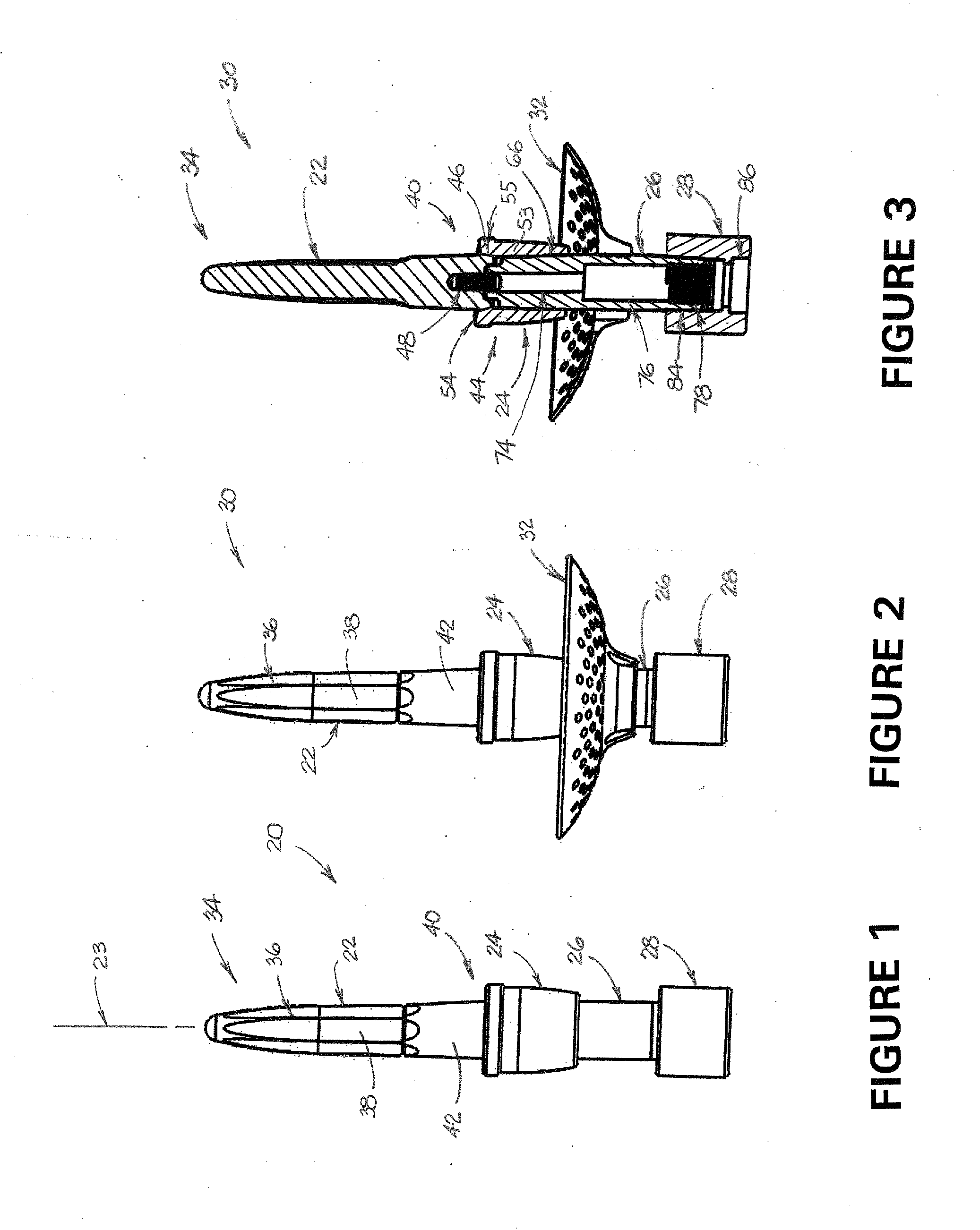 Percutaneous osseointegrated implant assembly for use in supporting an exo-prosthesis