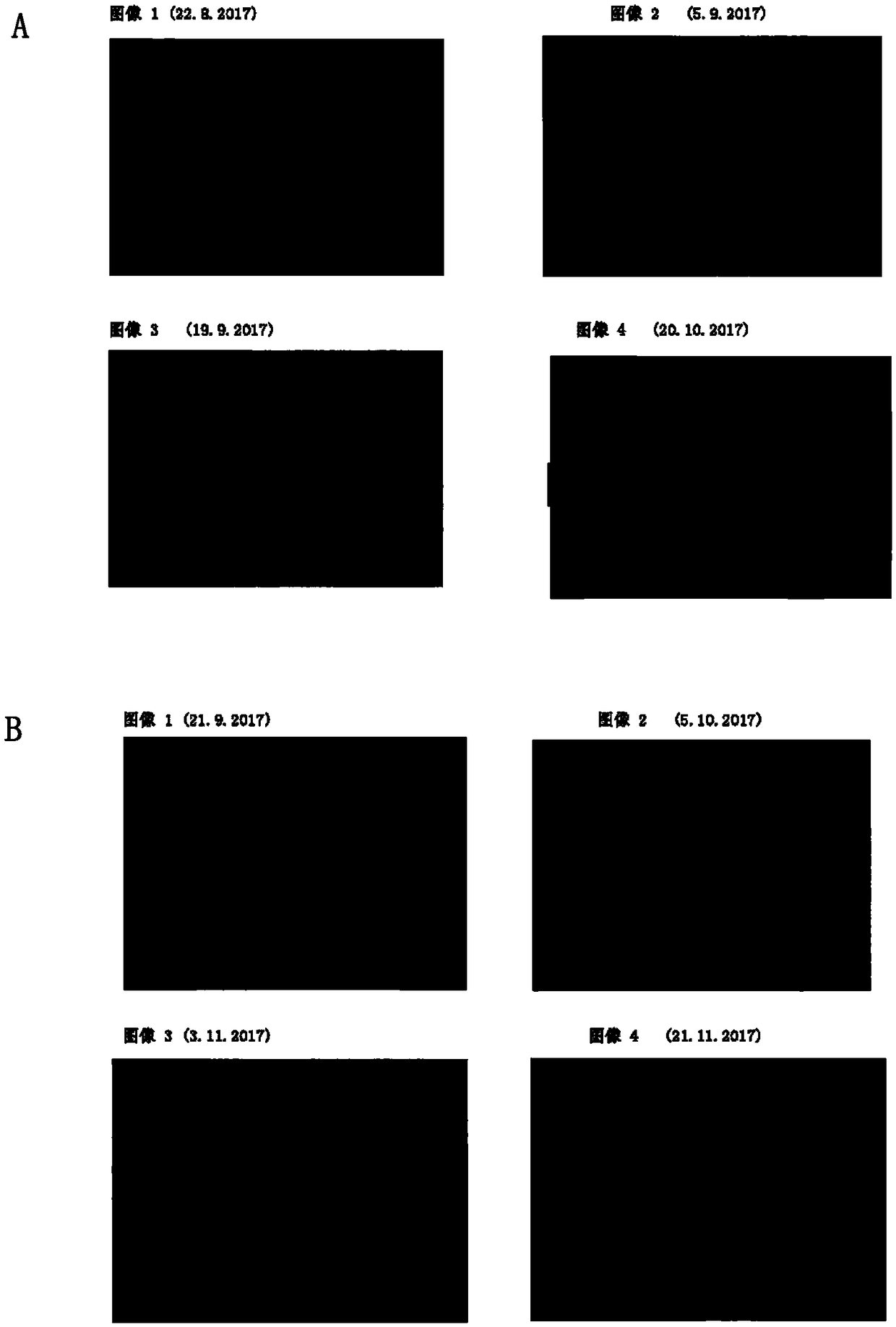 Anti-wrinkle cosmetic composition and preparation method thereof