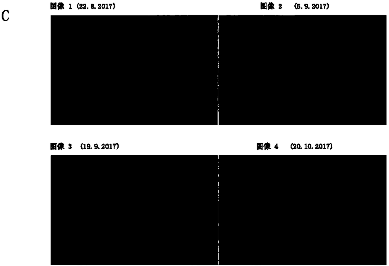 Anti-wrinkle cosmetic composition and preparation method thereof