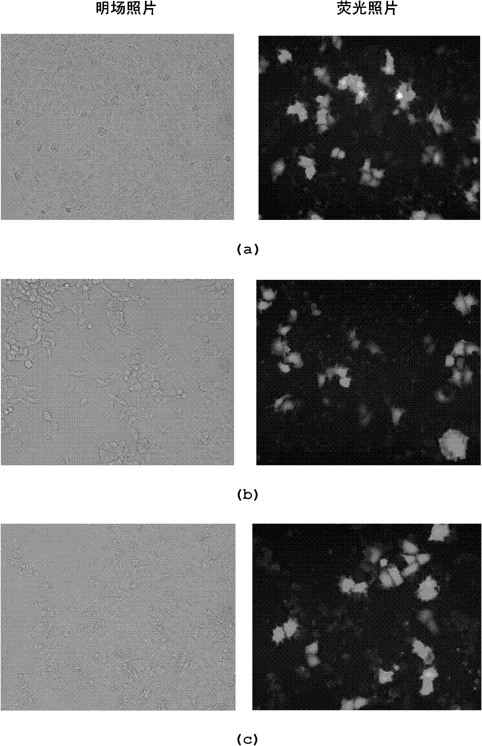 Lipoid cation function molecule synthesized from natural cholesterol and amino acid and preparation method and application thereof