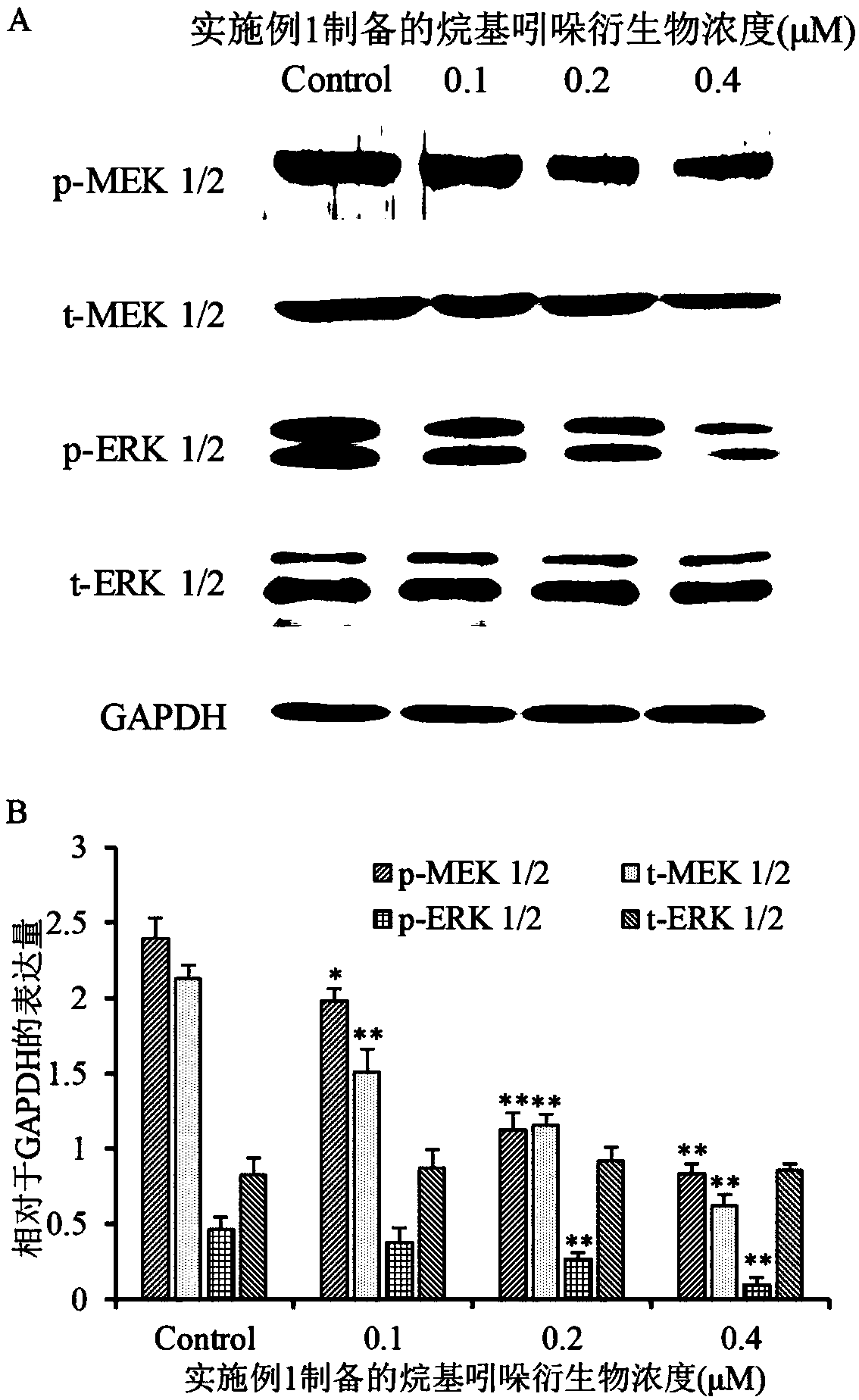 Application of alkyl indolone derivative and drug resisting thyroid tumor