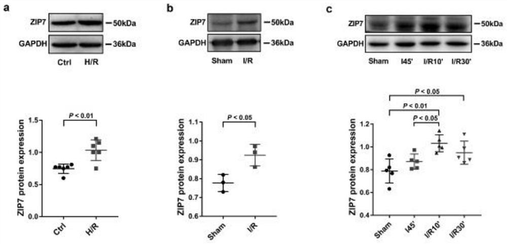 Target ZIP7 related to diagnosis, treatment, prevention and treatment of cardiovascular diseases and application of target ZIP7