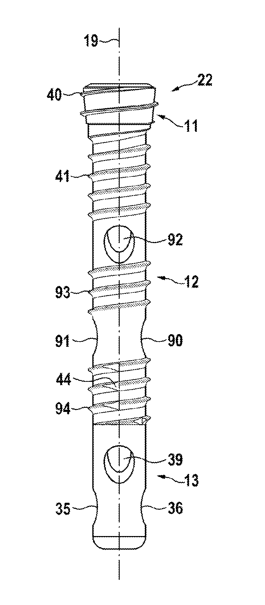 Cannulated bone screws