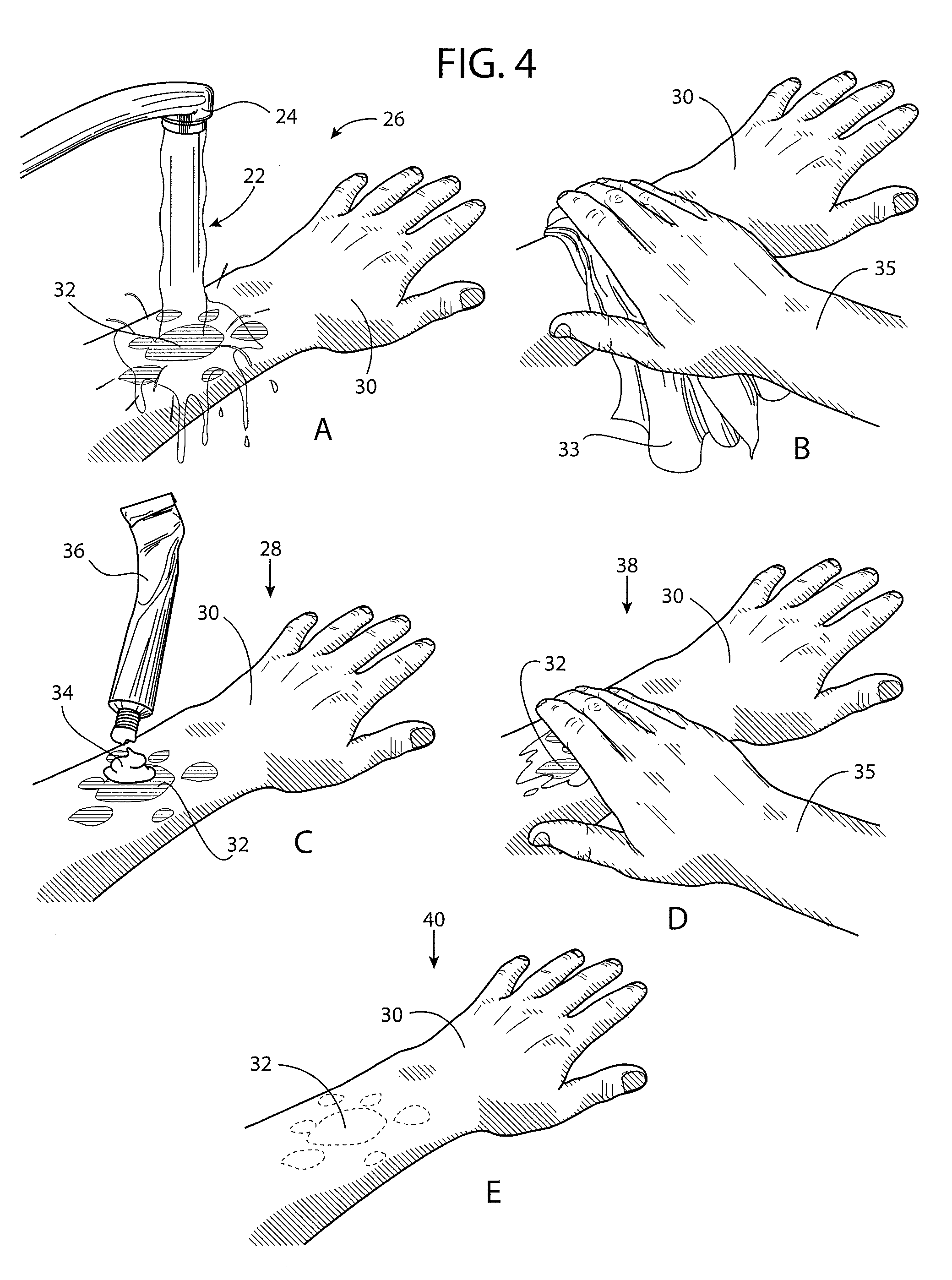 Method for purpura reduction and prevention