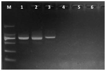 Specific Molecular Detection Primers for Soybean Gray Spot and Its Application