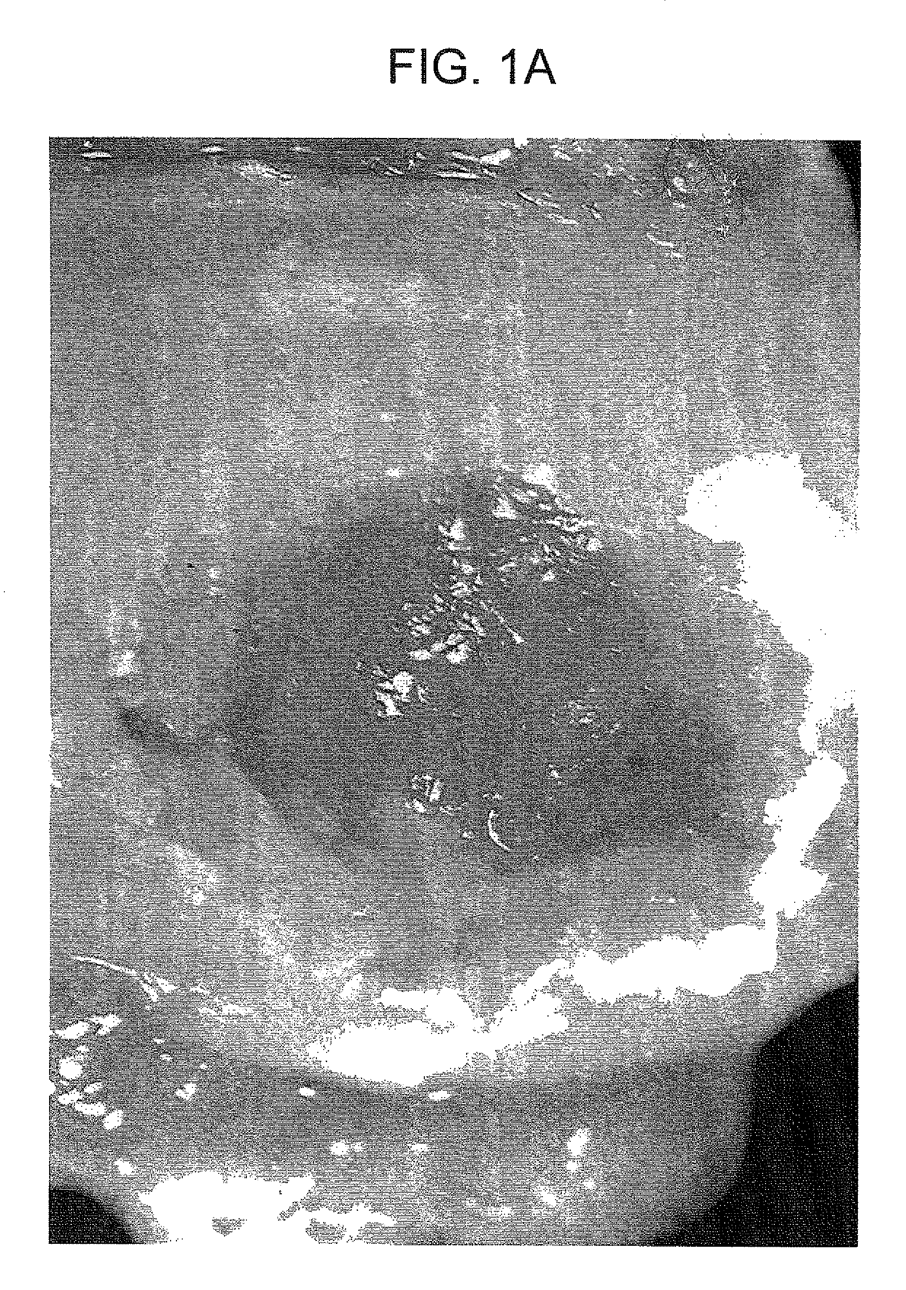 Method for regenerating cartilage