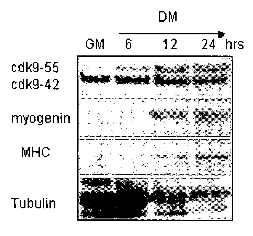 Regenerating and enhancing development of muscle tissue