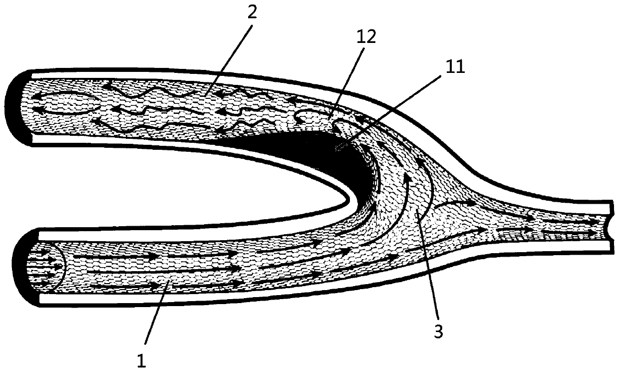 Medical intravascular implantation device