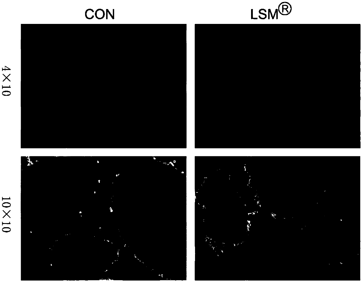 Mouse islet separation and purification method