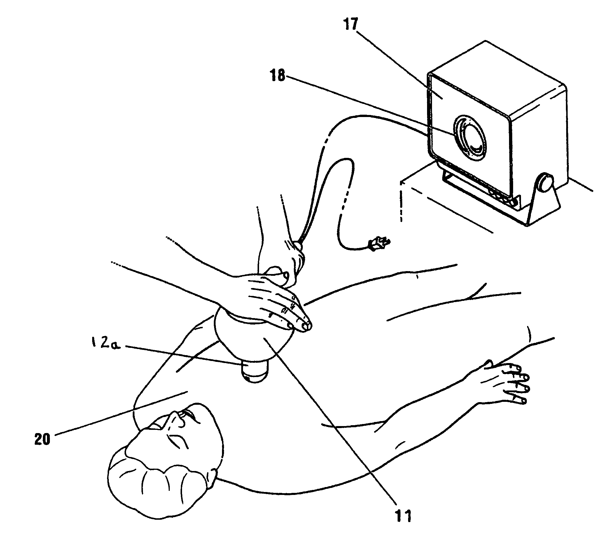 Percussion assisted angiogenesis