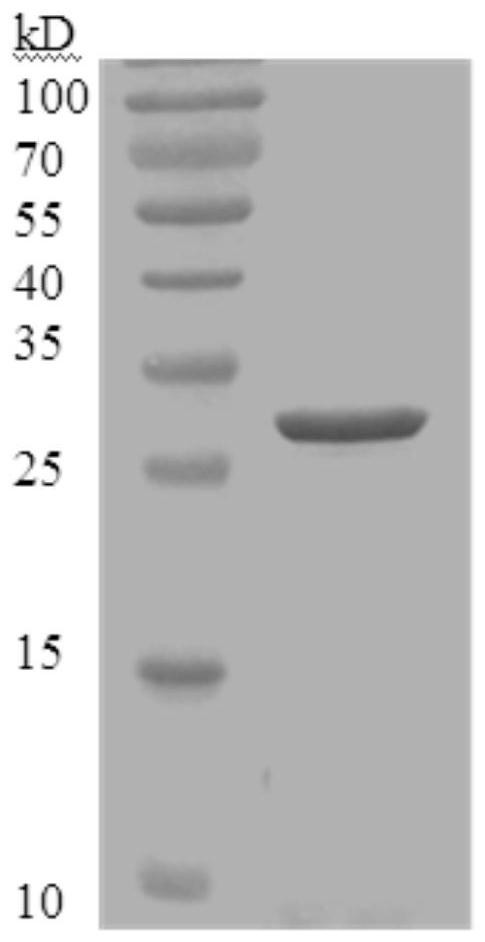 A monoclonal antibody yg11-2 against Staphylococcus aureus enterotoxin b and its application