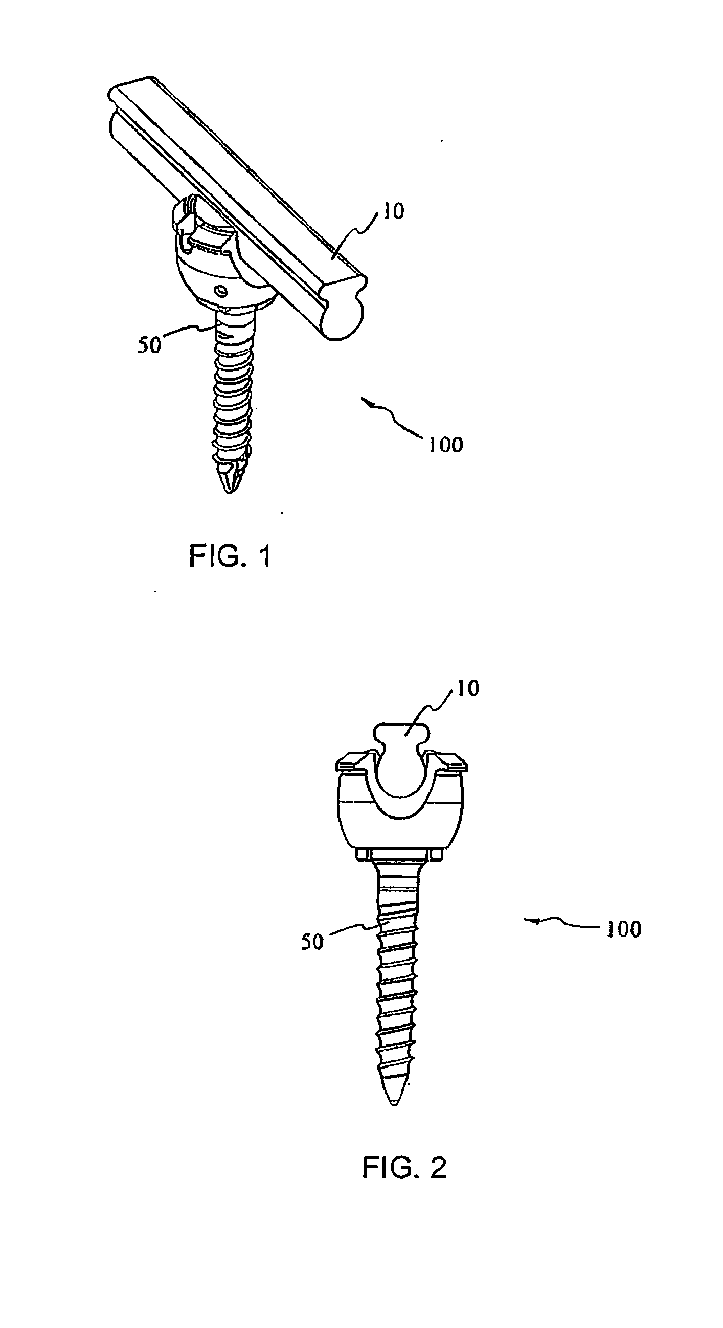 Spine stabilization system