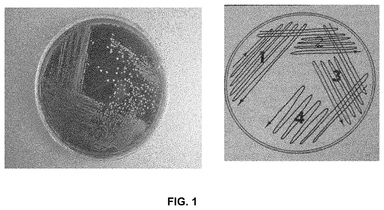 Methods for inhibiting tumor growth using anaerobe microorganisms