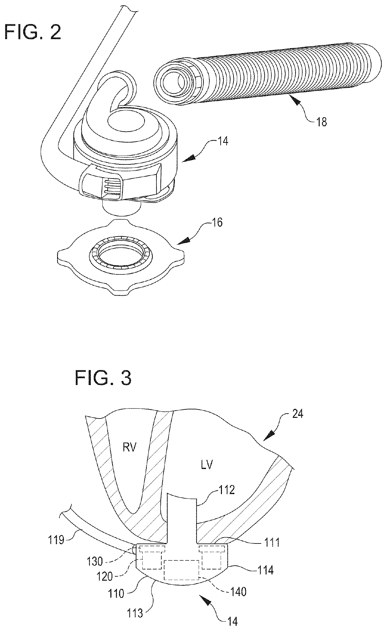 Adaptive Speed Control Algorithms and Controllers for Optimizing Flow in Ventricular Assist Devices