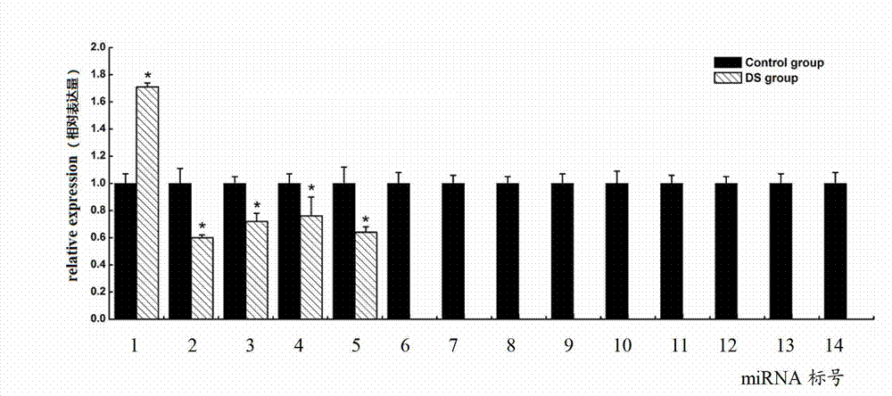 Down syndrome 21 chromosome miRNA differential expression map model, modeling method and application