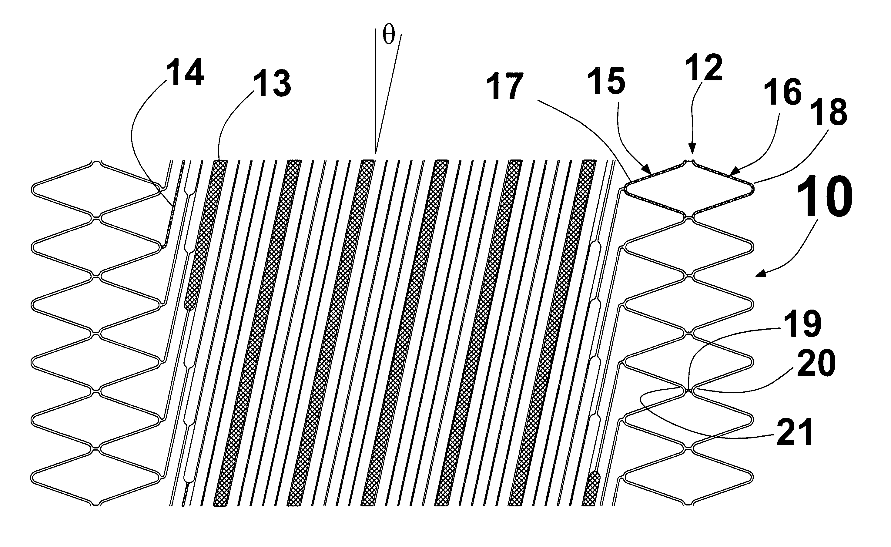 Helical stent