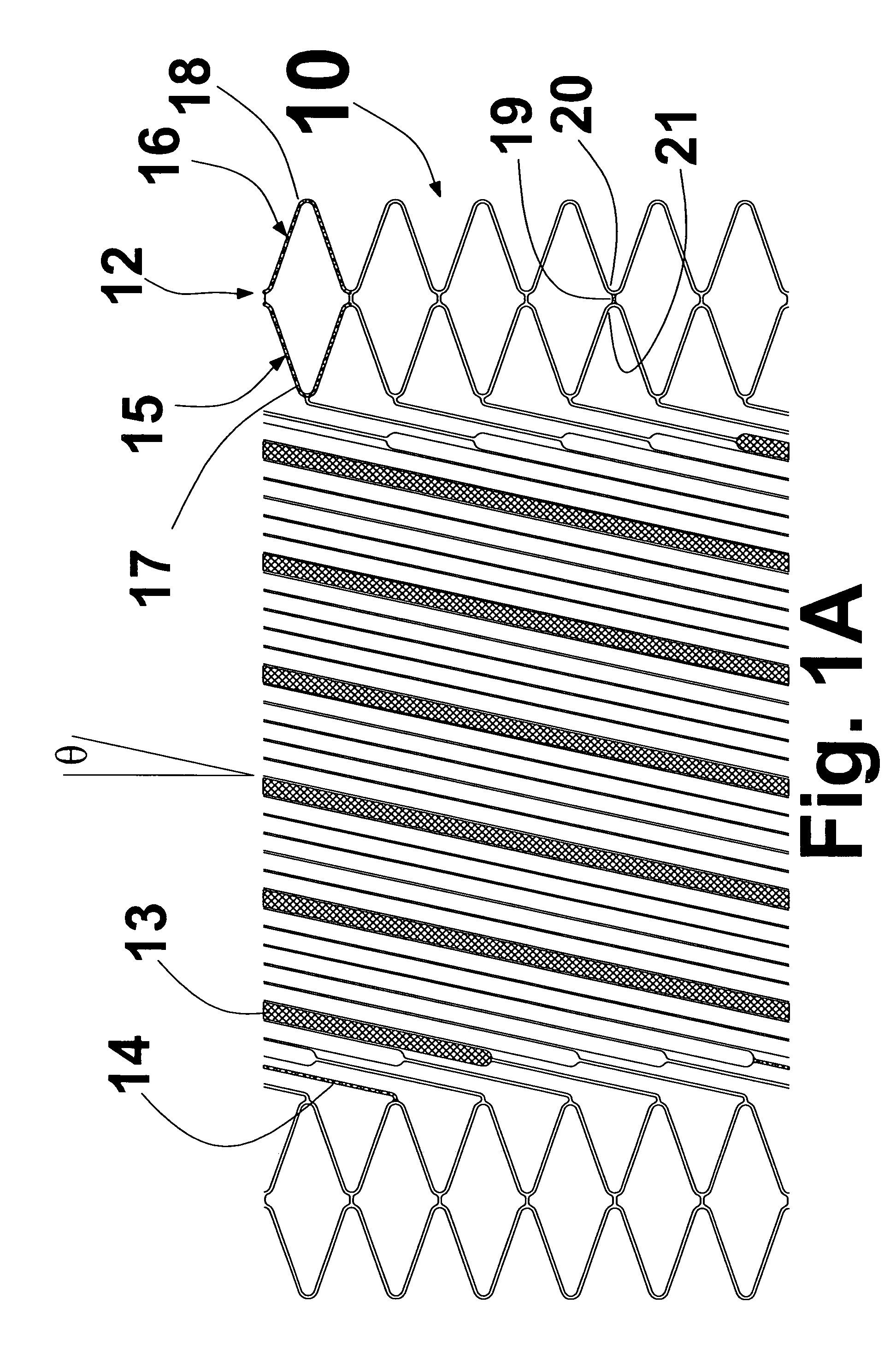 Helical stent