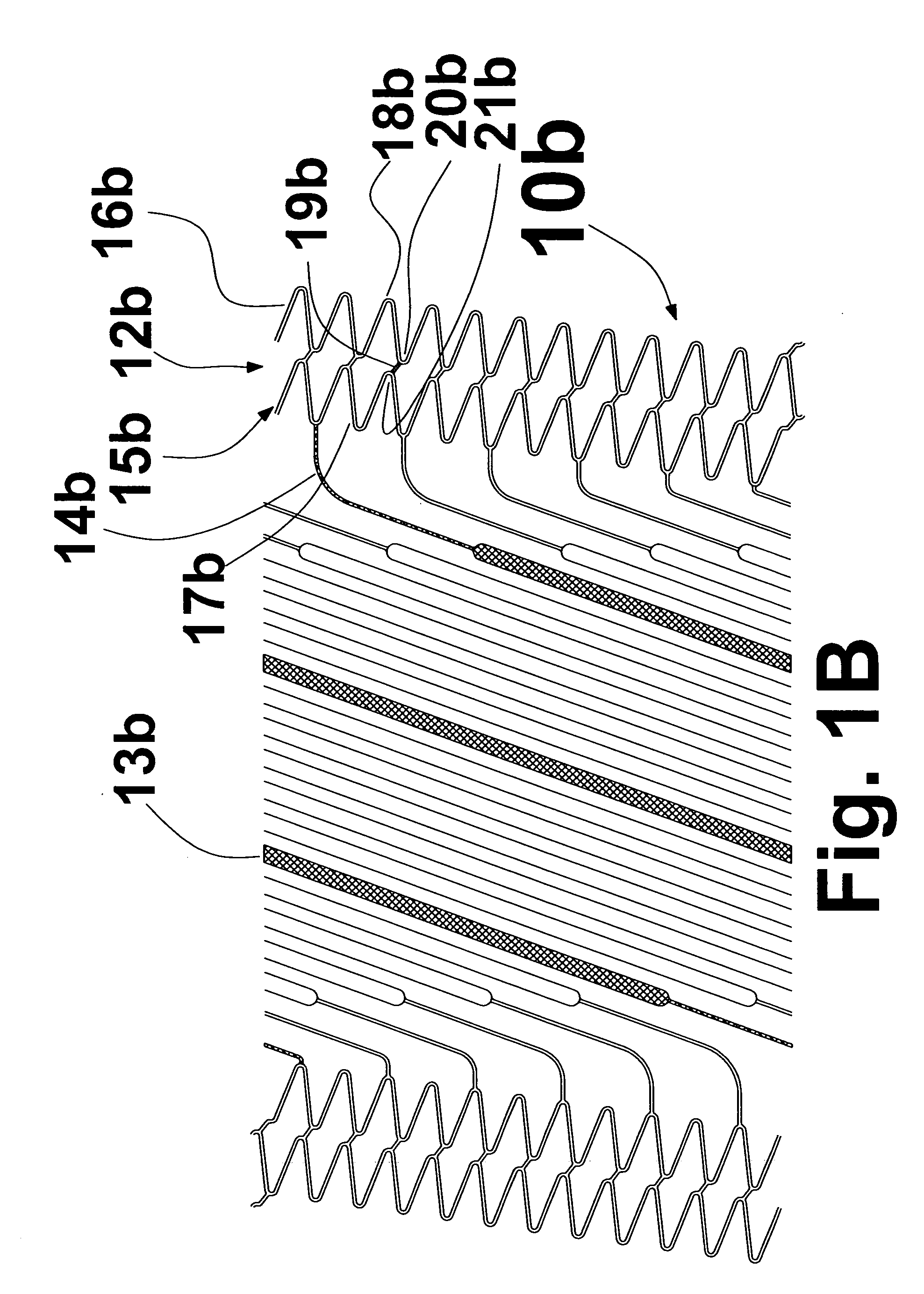 Helical stent