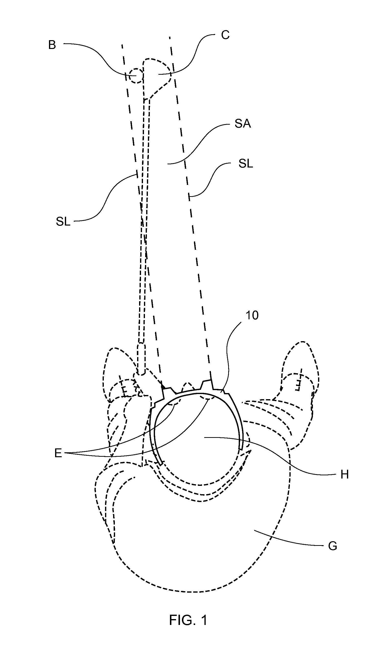 Golf training glasses and method of use thereof