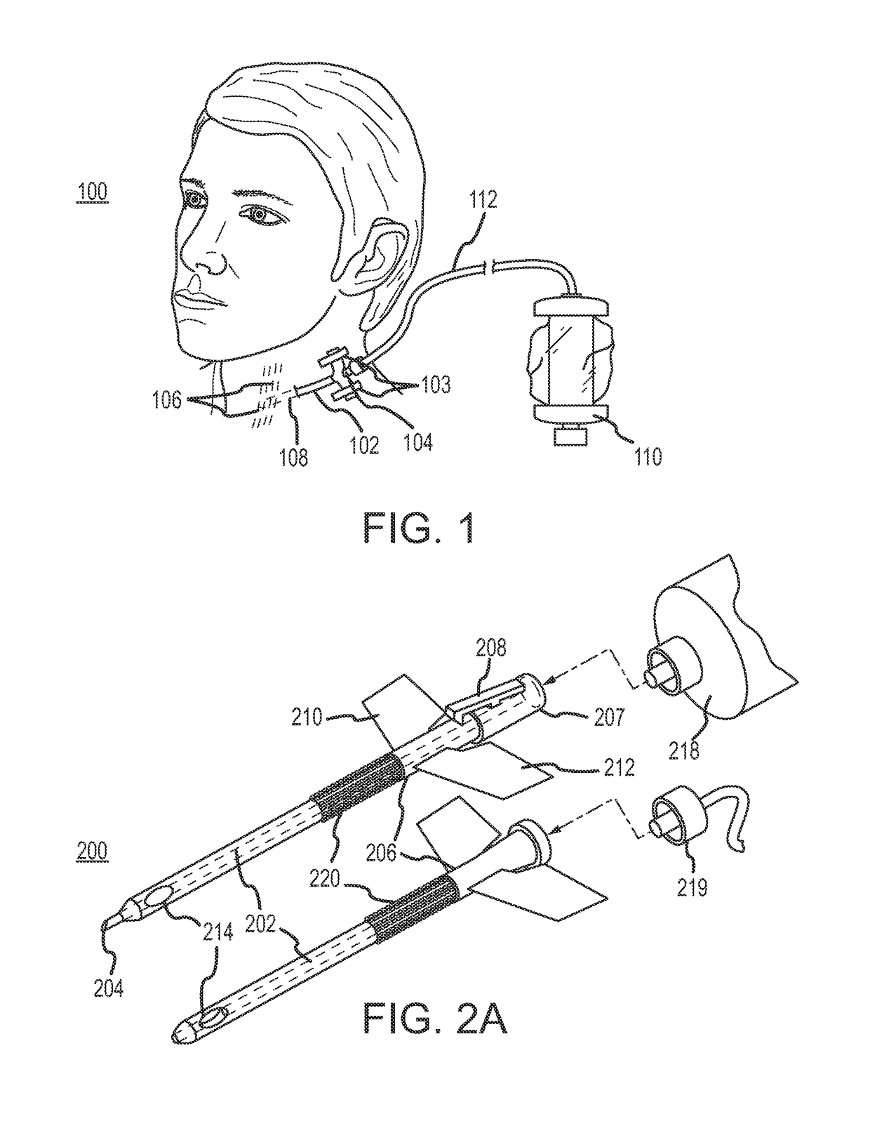 Ultrasound monitored continuous anesthesia nerve conduction apparatus and method by bolus injection