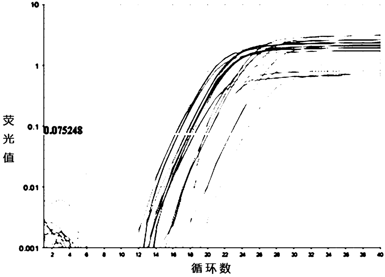 Kit for detecting chronic sinusitis with nasal polyp subtype, and application of CST1 gene as biomarker