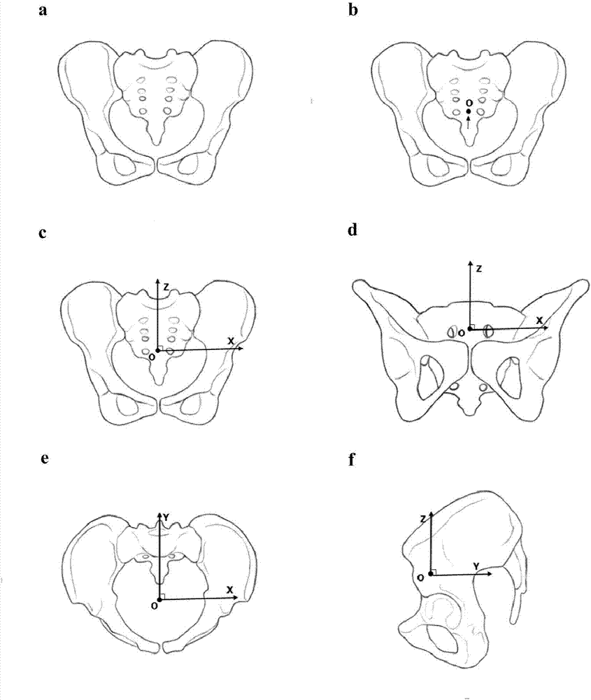 Pelvis CT three-dimensional reconstruction image postprocessing method based on coordinate system