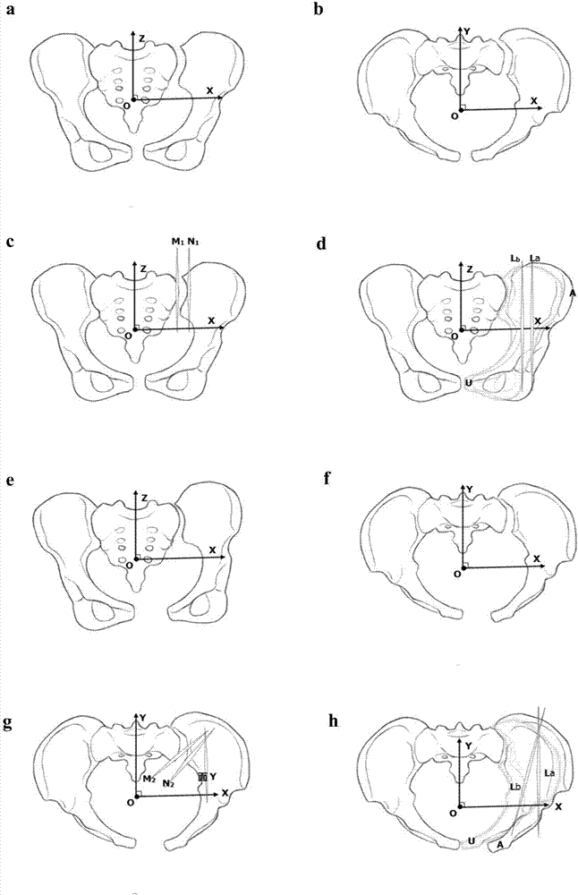 Pelvis CT three-dimensional reconstruction image postprocessing method based on coordinate system