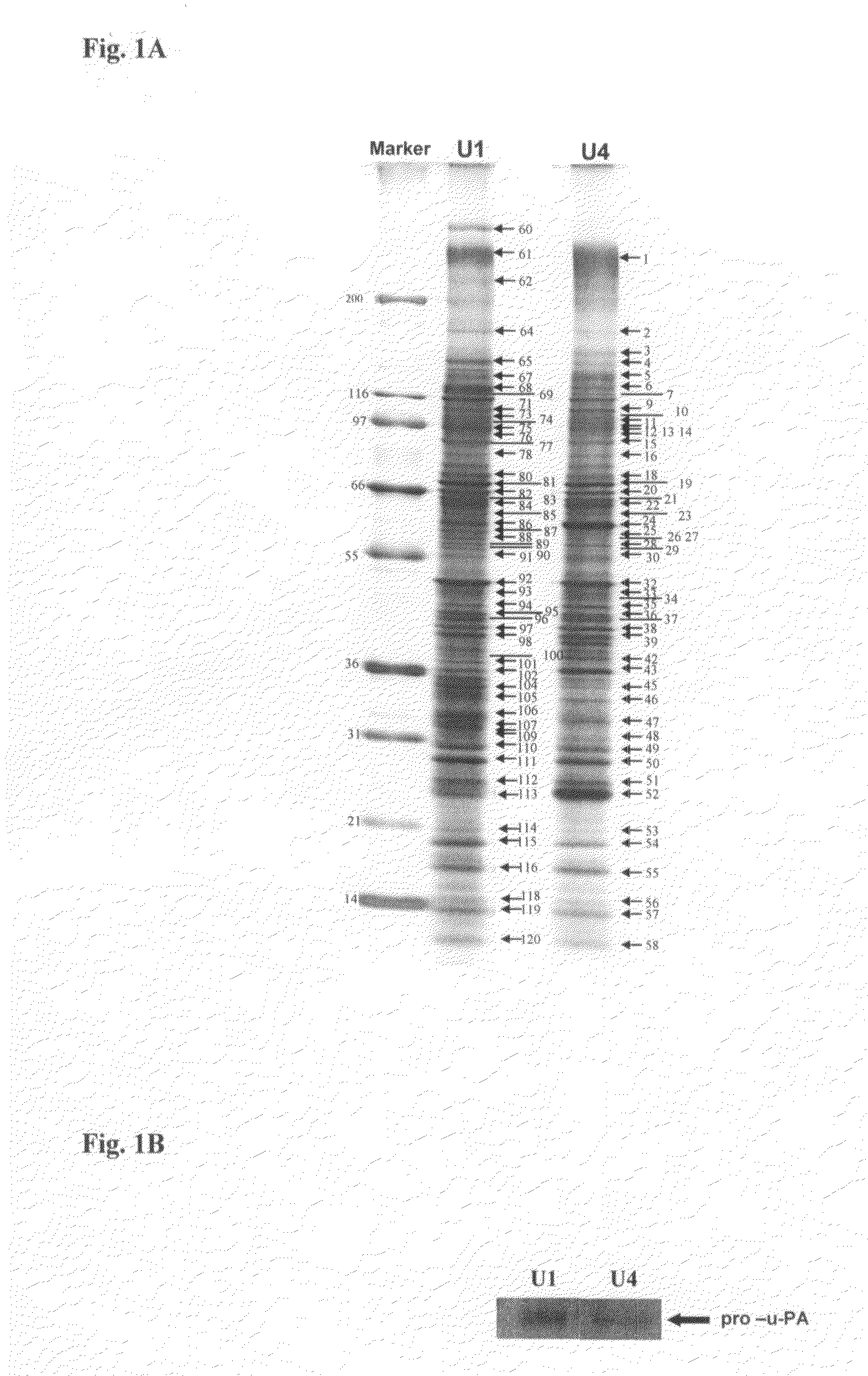 Method of identifying cancer biomarkers and cancer progression