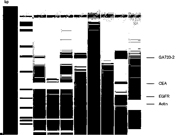 Kit for detecting free colorectal cancer cell markers in blood