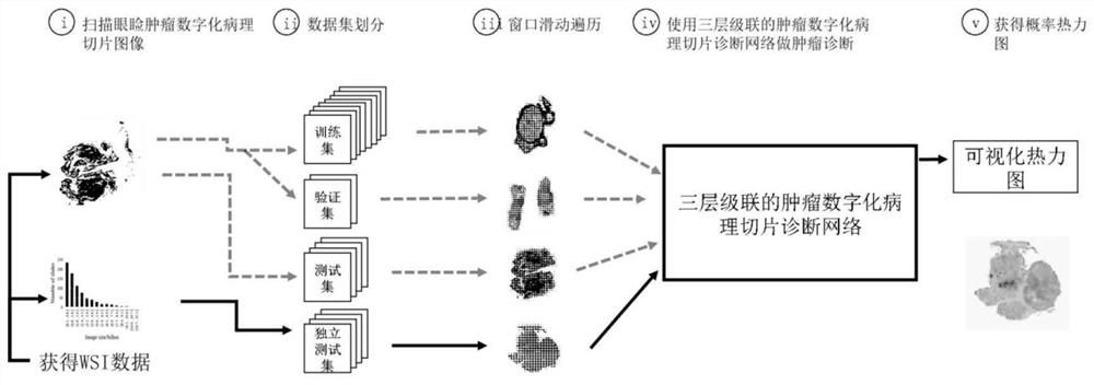 Eyelid tumor digital pathological section image multi-classification method based on deep learning