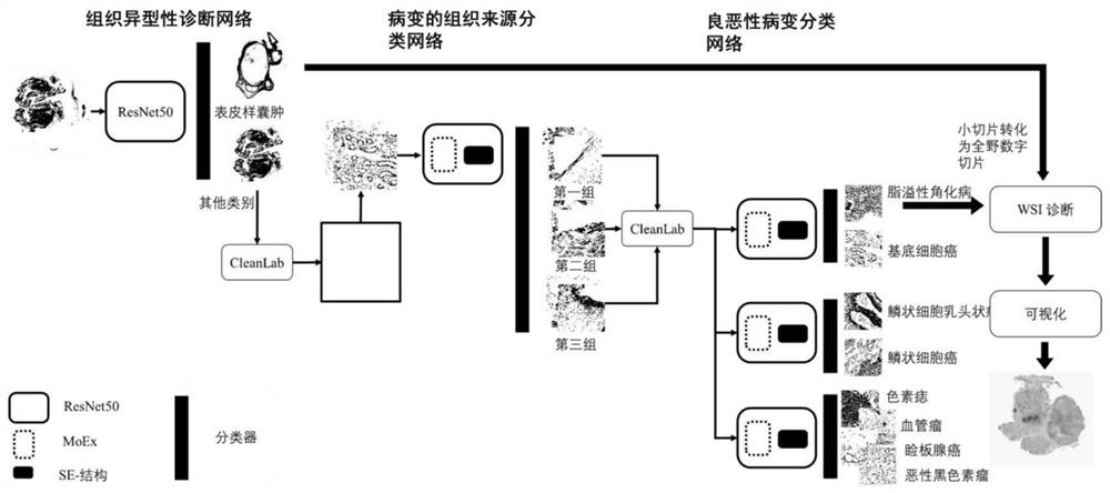 Eyelid tumor digital pathological section image multi-classification method based on deep learning