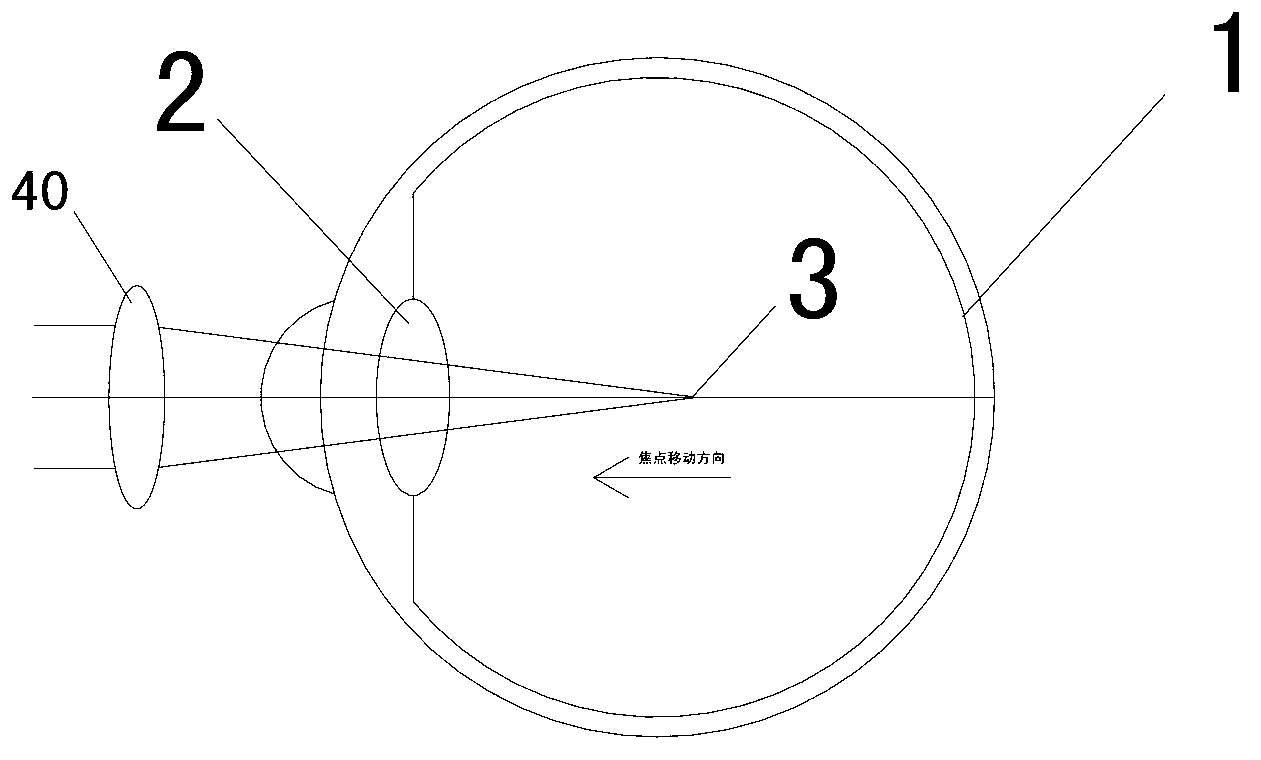 Lens combination method for adjusting intraocular optical focal positions